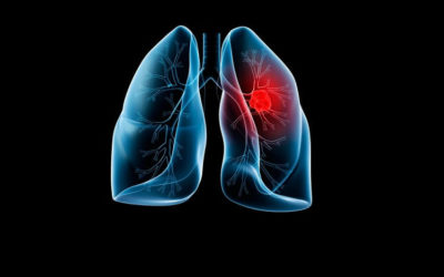 Third-generation inhibitors targeting EGFR T790M mutation in advanced NSCLC